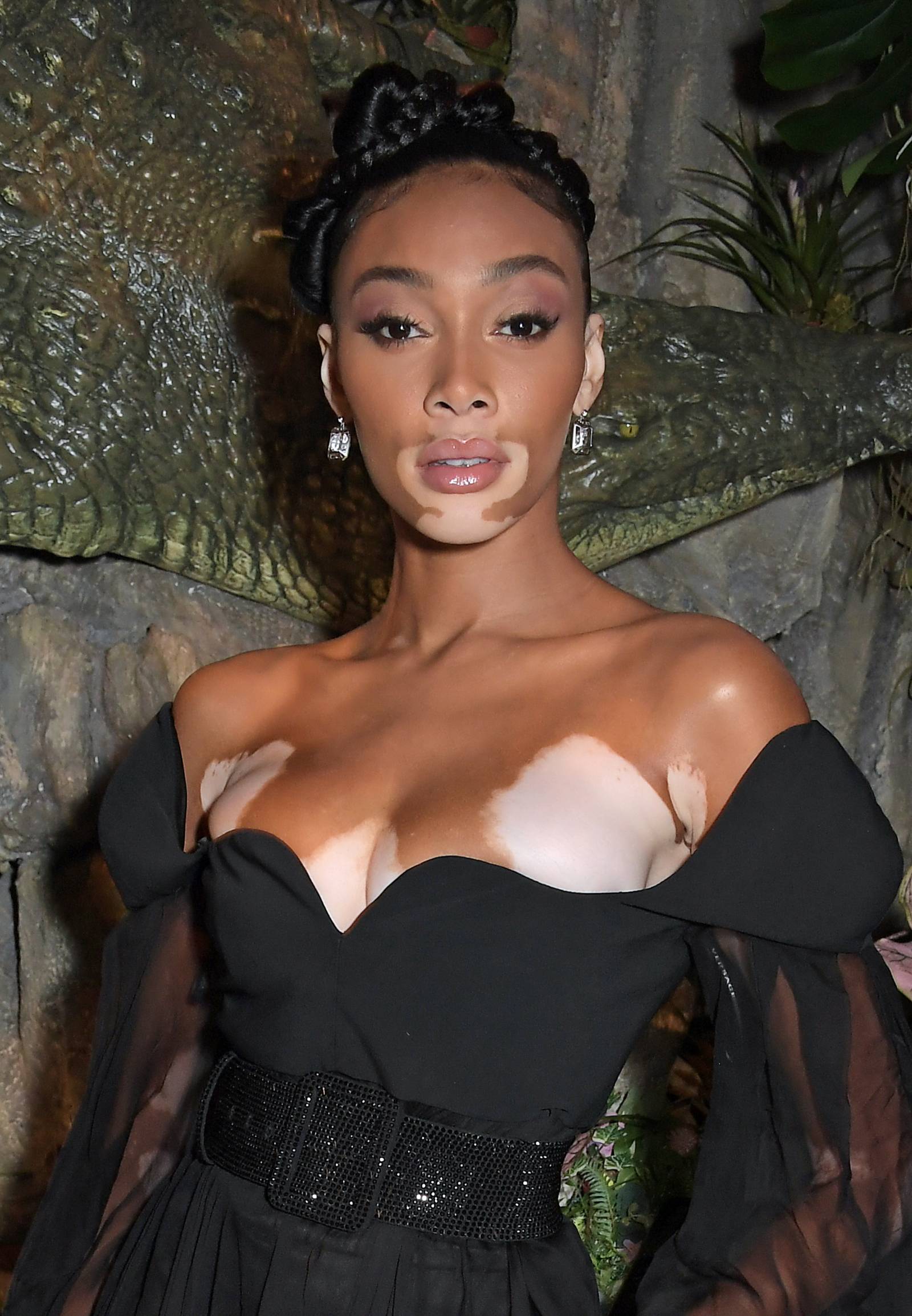 Winnie Harlow (Fot. Getty Images)